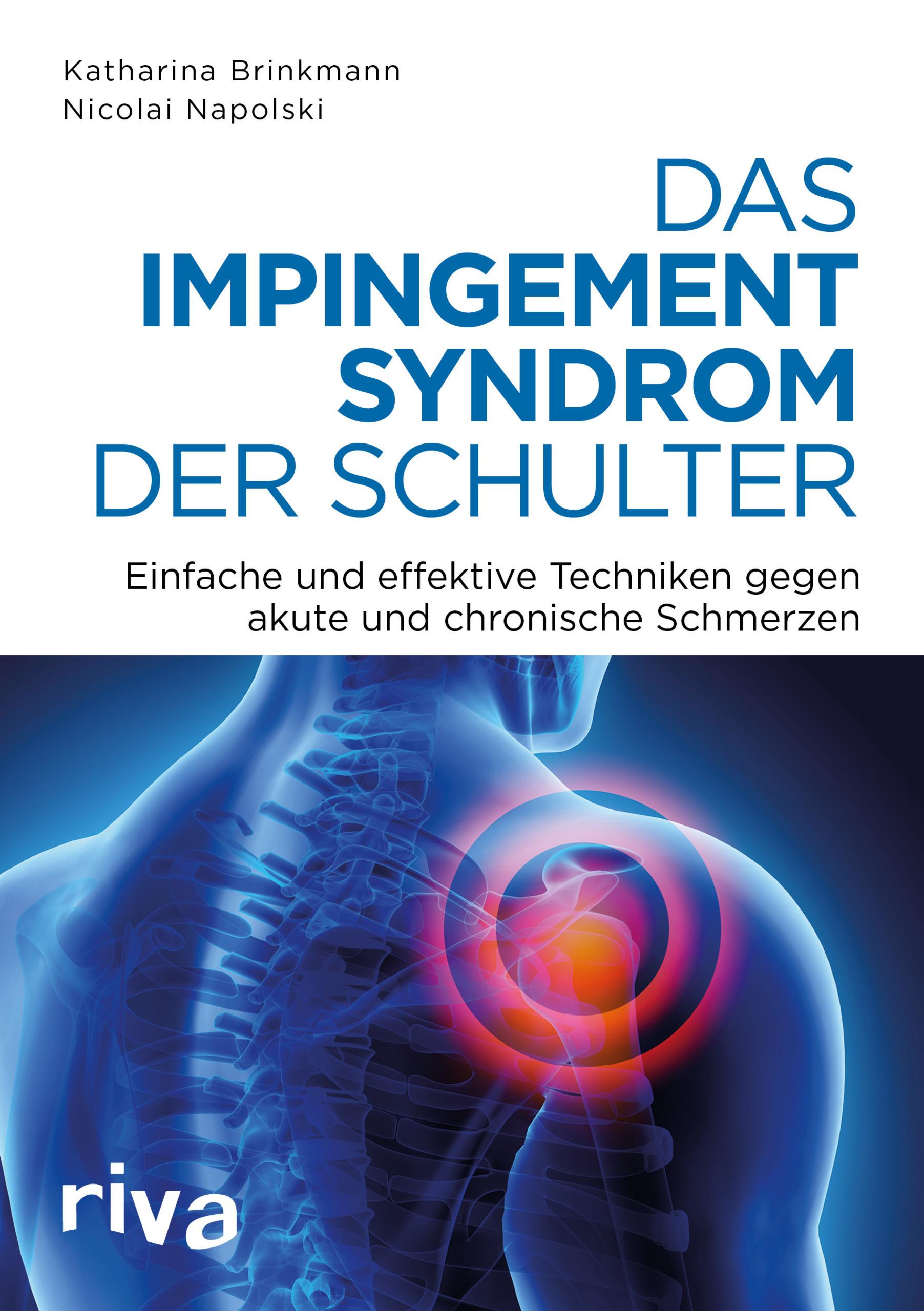 Das Impingement-Syndrom der Schulter