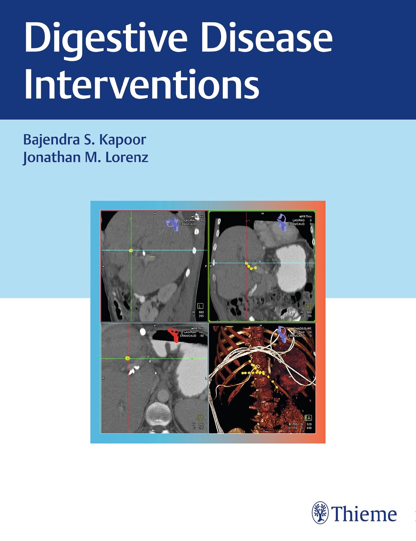 Digestive Disease Interventions