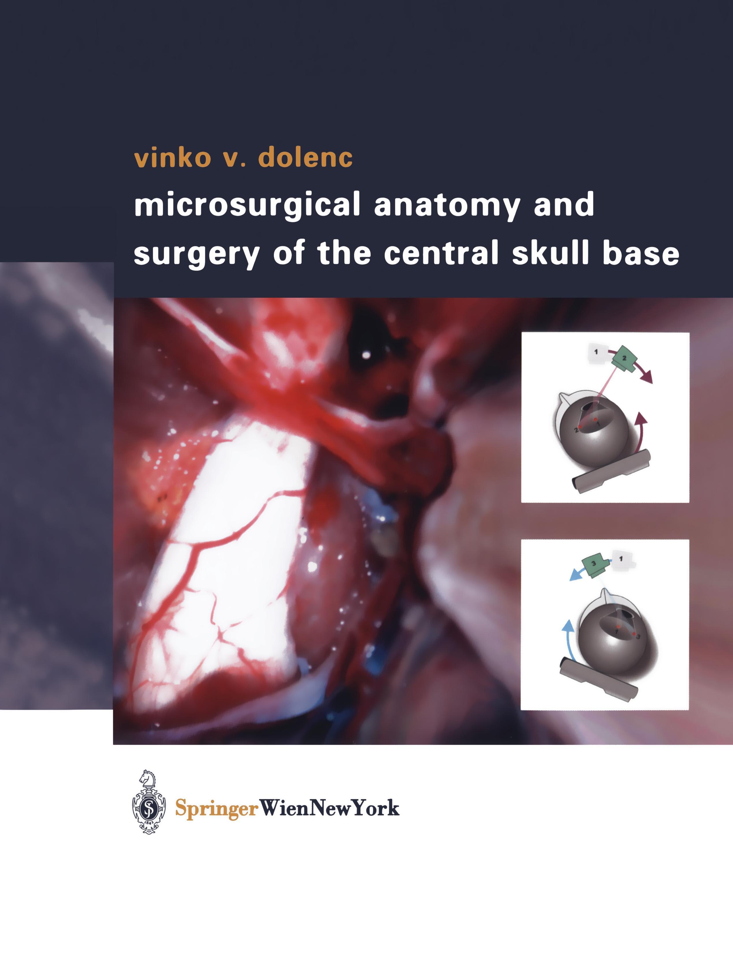 Microsurgical Anatomy and Surgery of the Central Skull Base