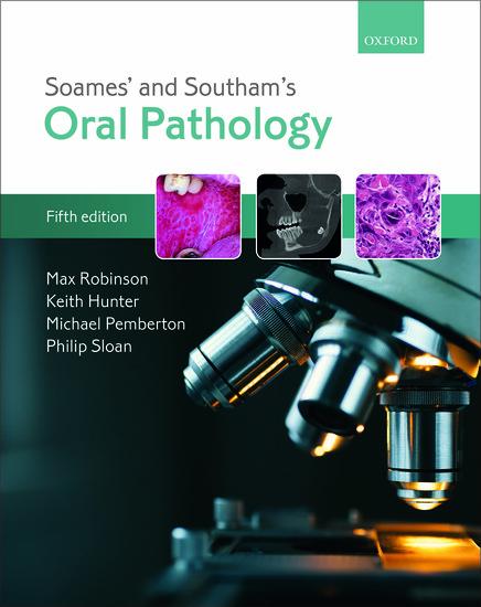 Soames' & Southam's Oral Pathology