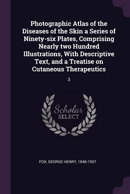 Photographic Atlas of the Diseases of the Skin a Series of Ninety-six Plates, Comprising Nearly two Hundred Illustrations, With Descriptive Text, and a Treatise on Cutaneous Therapeutics