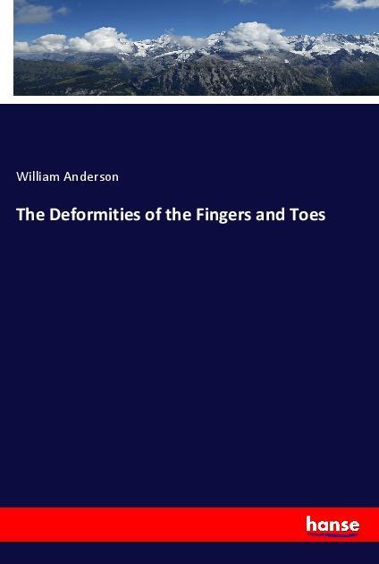 The Deformities of the Fingers and Toes