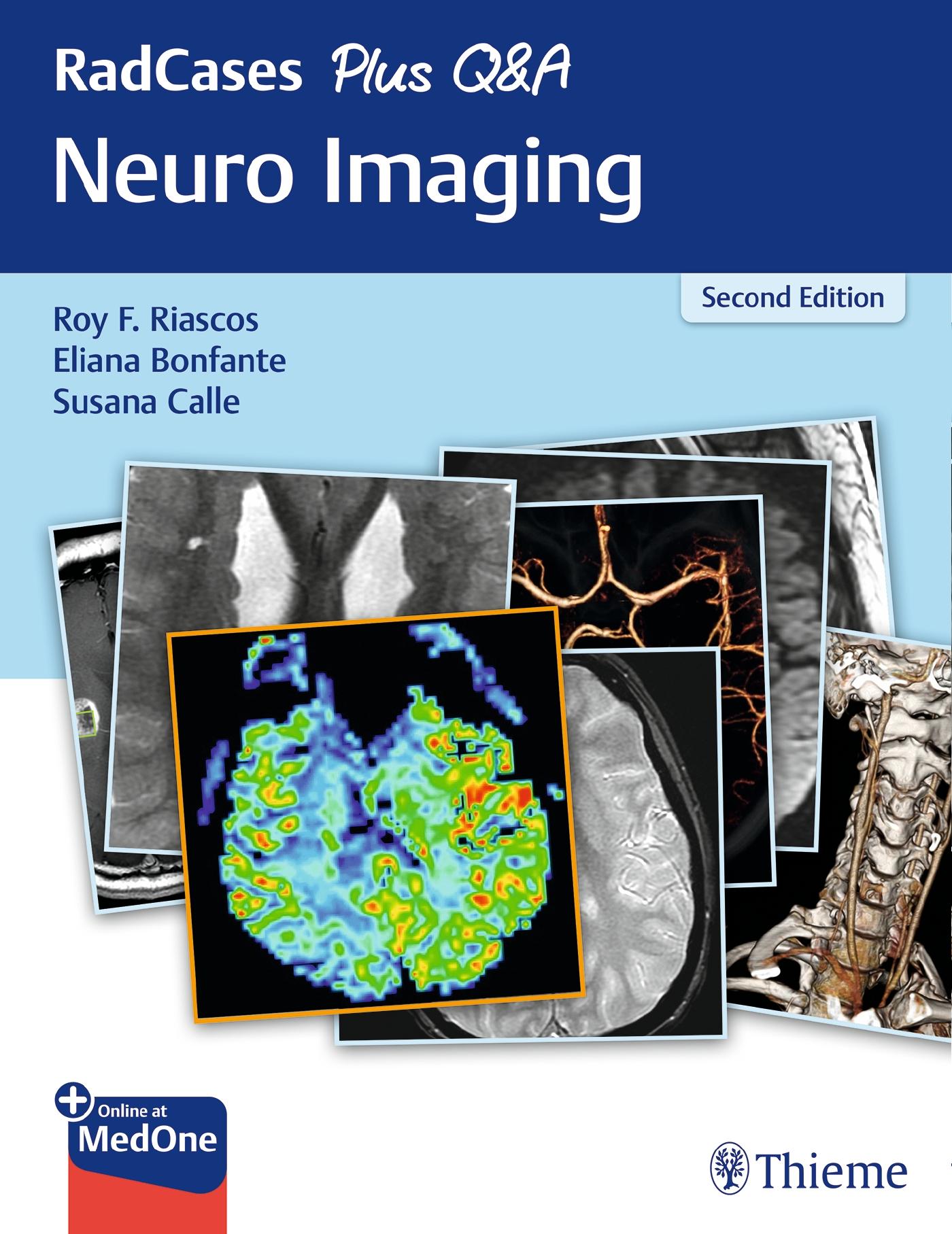 Radcases Plus Q&A Neuro Imaging