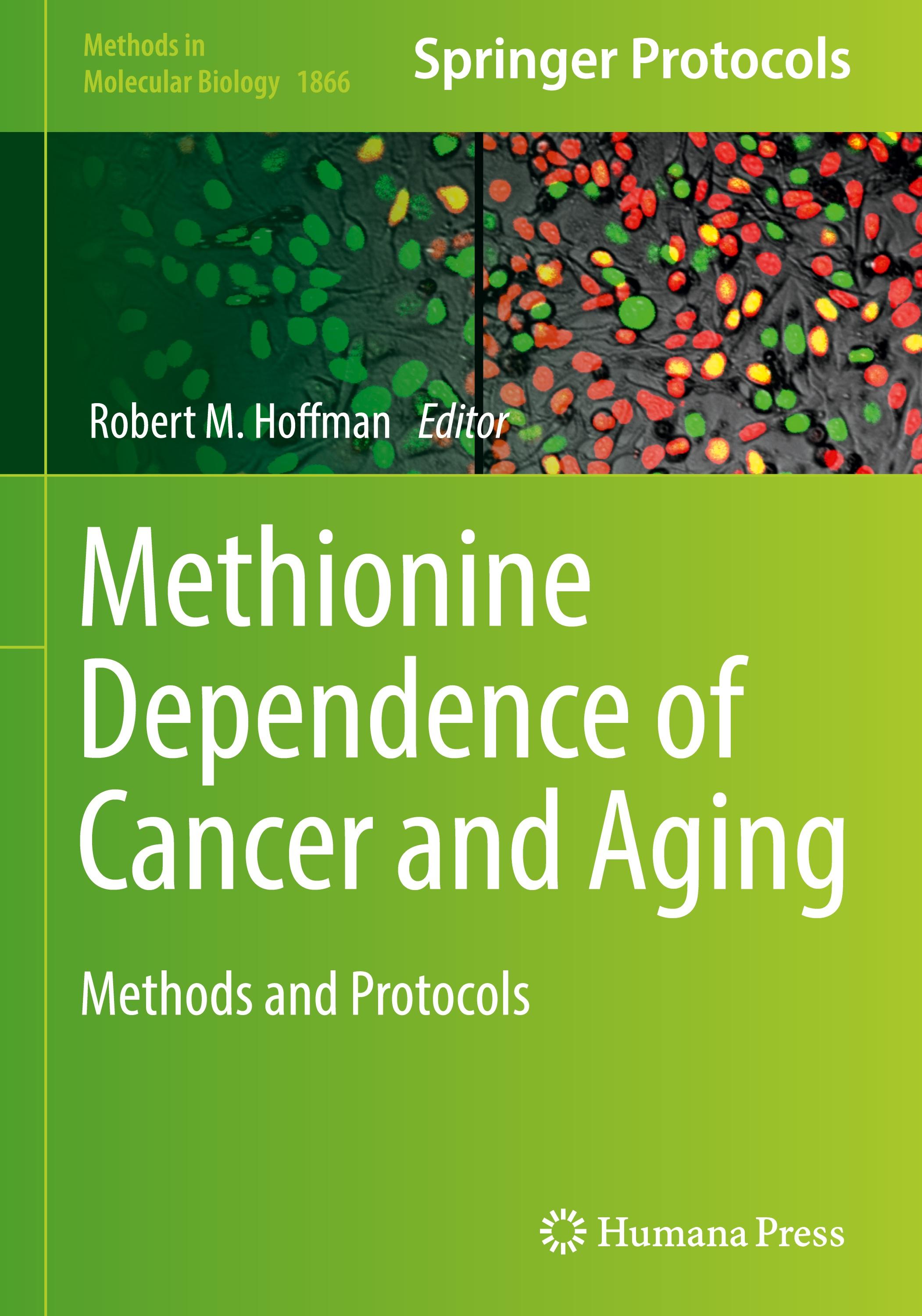 Methionine Dependence of Cancer and Aging