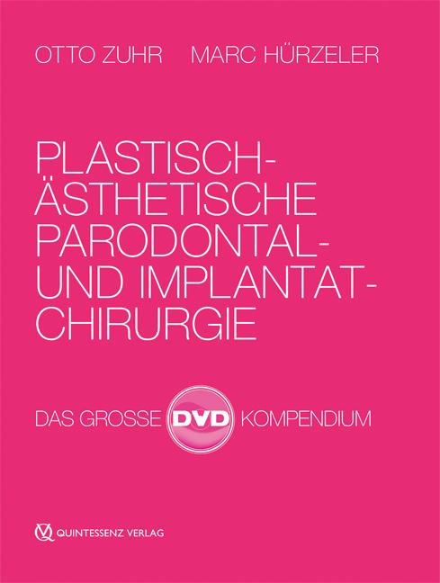 Plastisch-Ästhetische Parodontal- und Implantatchirurgie