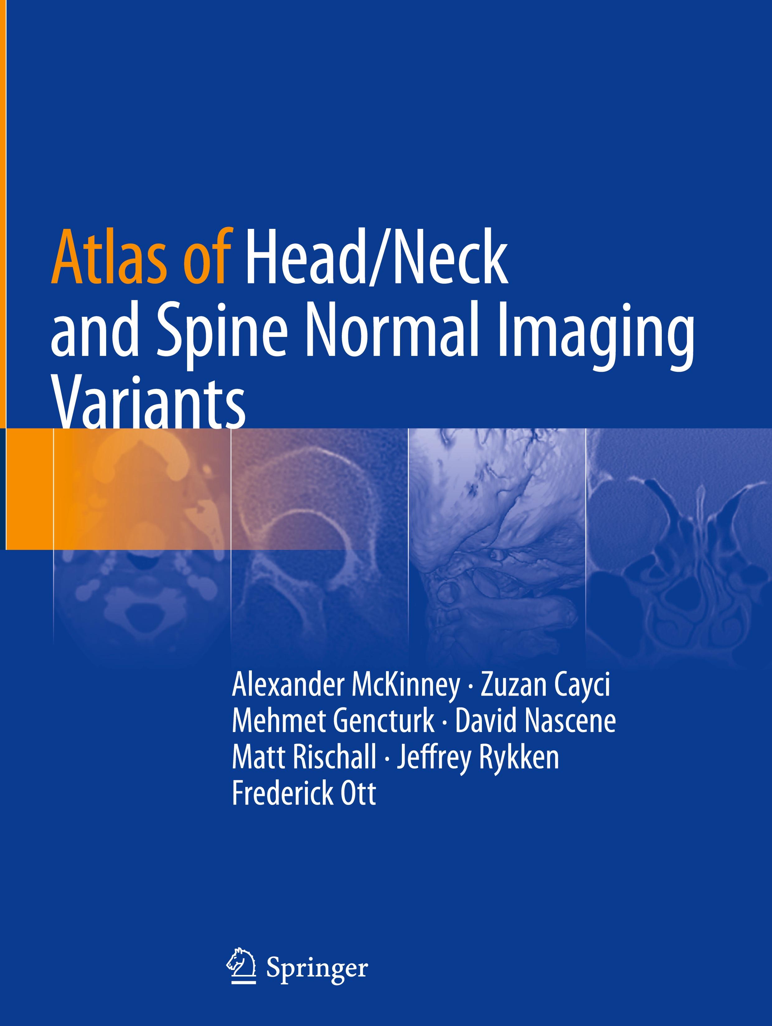 Atlas of Head/Neck and Spine Normal Imaging Variants