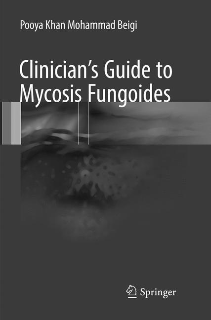 Clinician's Guide to Mycosis Fungoides