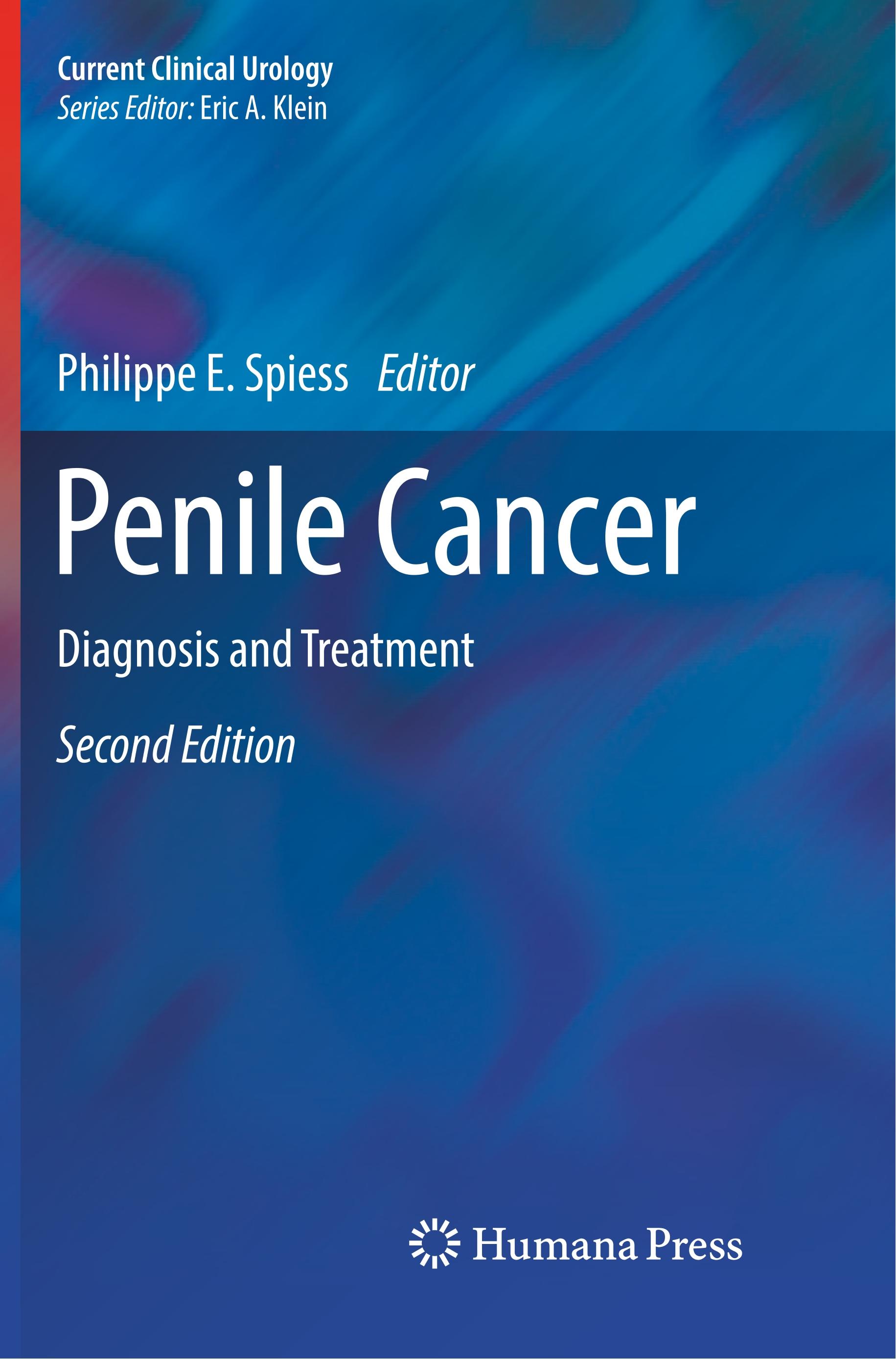 Penile Cancer