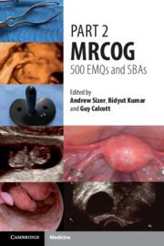 Part 2 MRCOG: 500 EMQs and SBAs