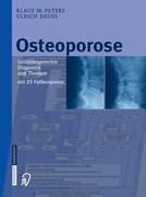 Osteoporose