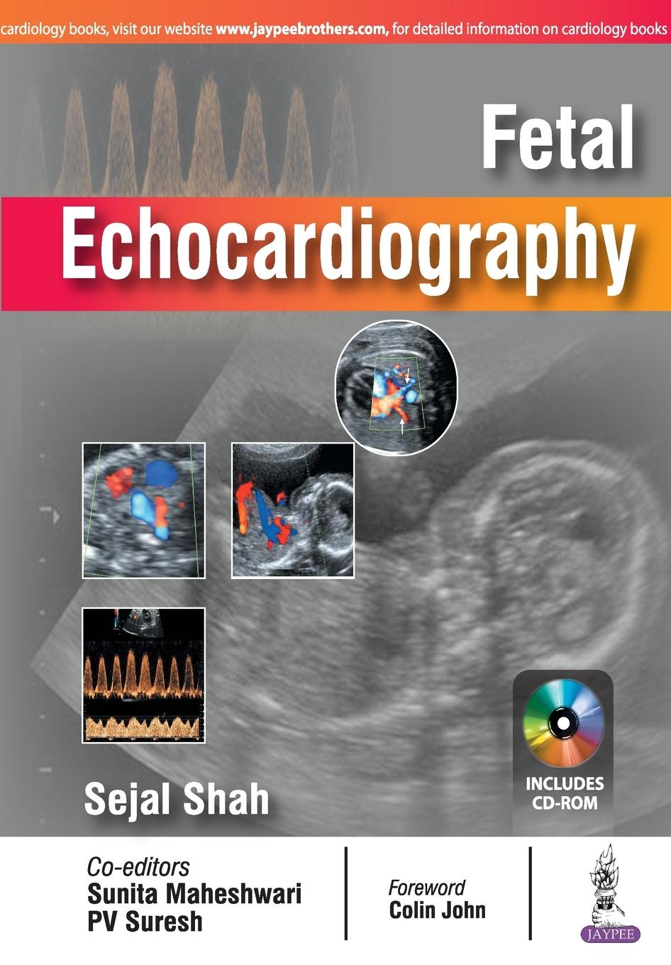 Fetal Echocardiography