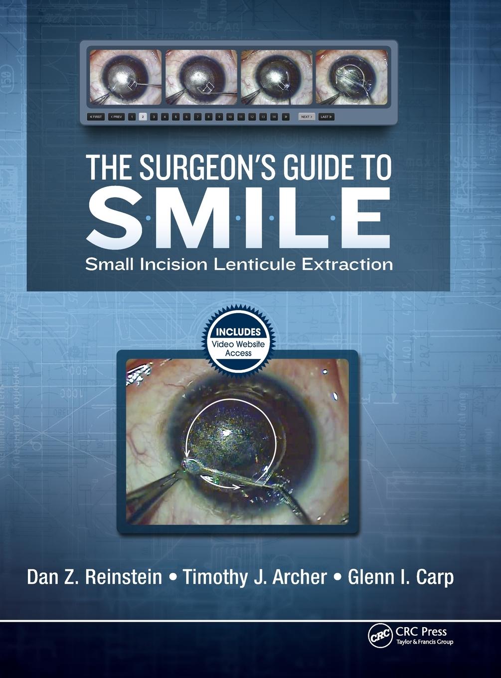 The Surgeon's Guide to SMILE