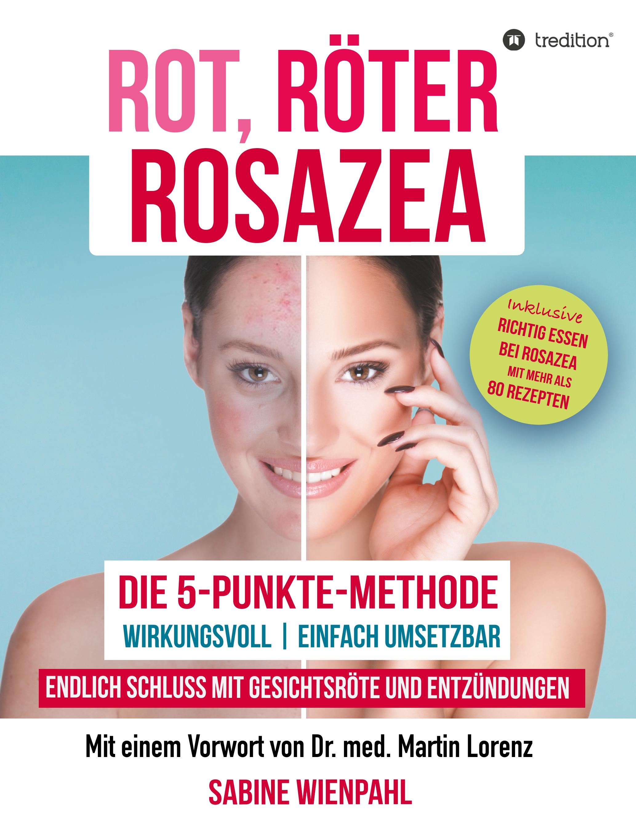 ROT RÖTER ROSAZEA