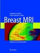 Breast MRI