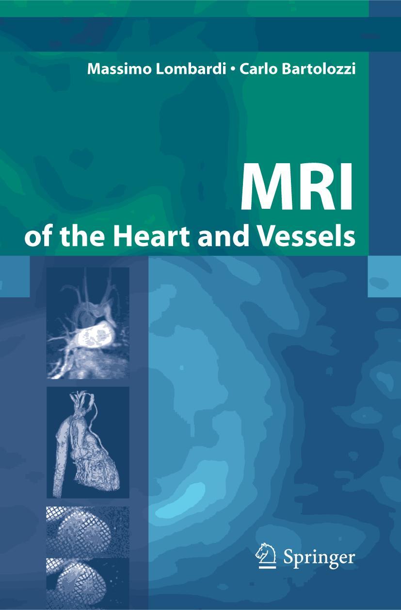 MRI of the Heart and Vessels