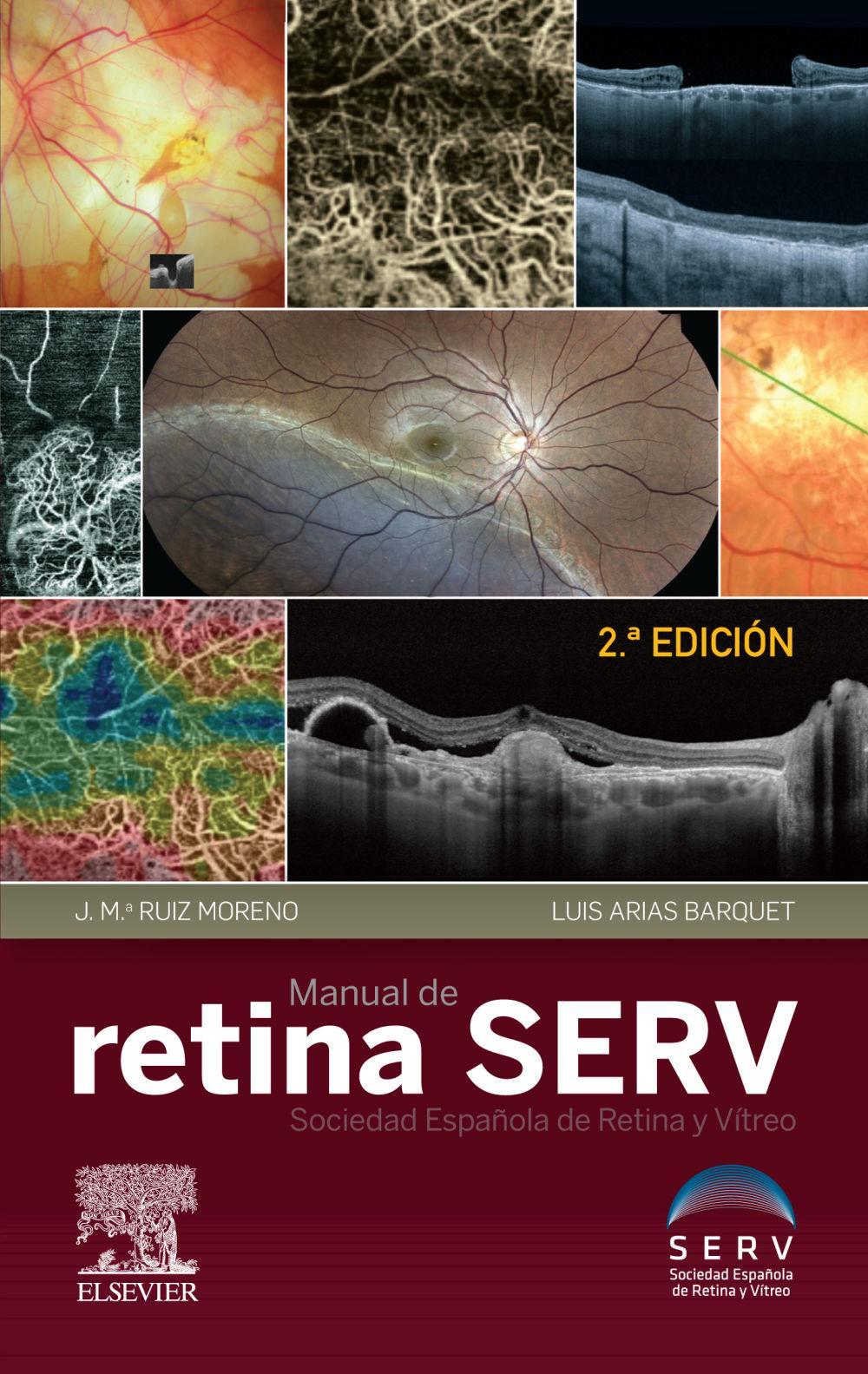 Manual de retina