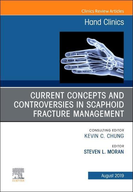 Current Concepts and Controversies in Scaphoid Fracture Management, an Issue of Hand Clinics