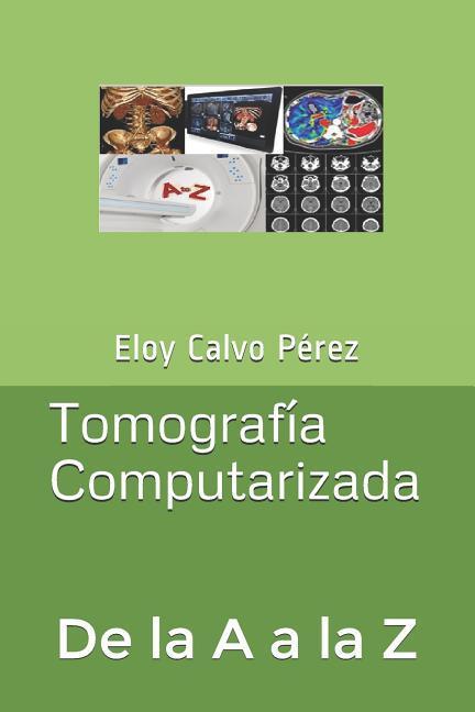 Tomografía Computarizada