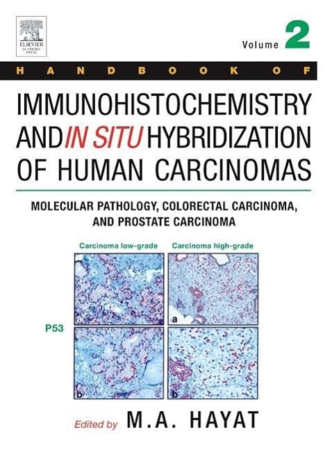 Handbook of Immunohistochemistry and in Situ Hybridization of Human Carcinomas