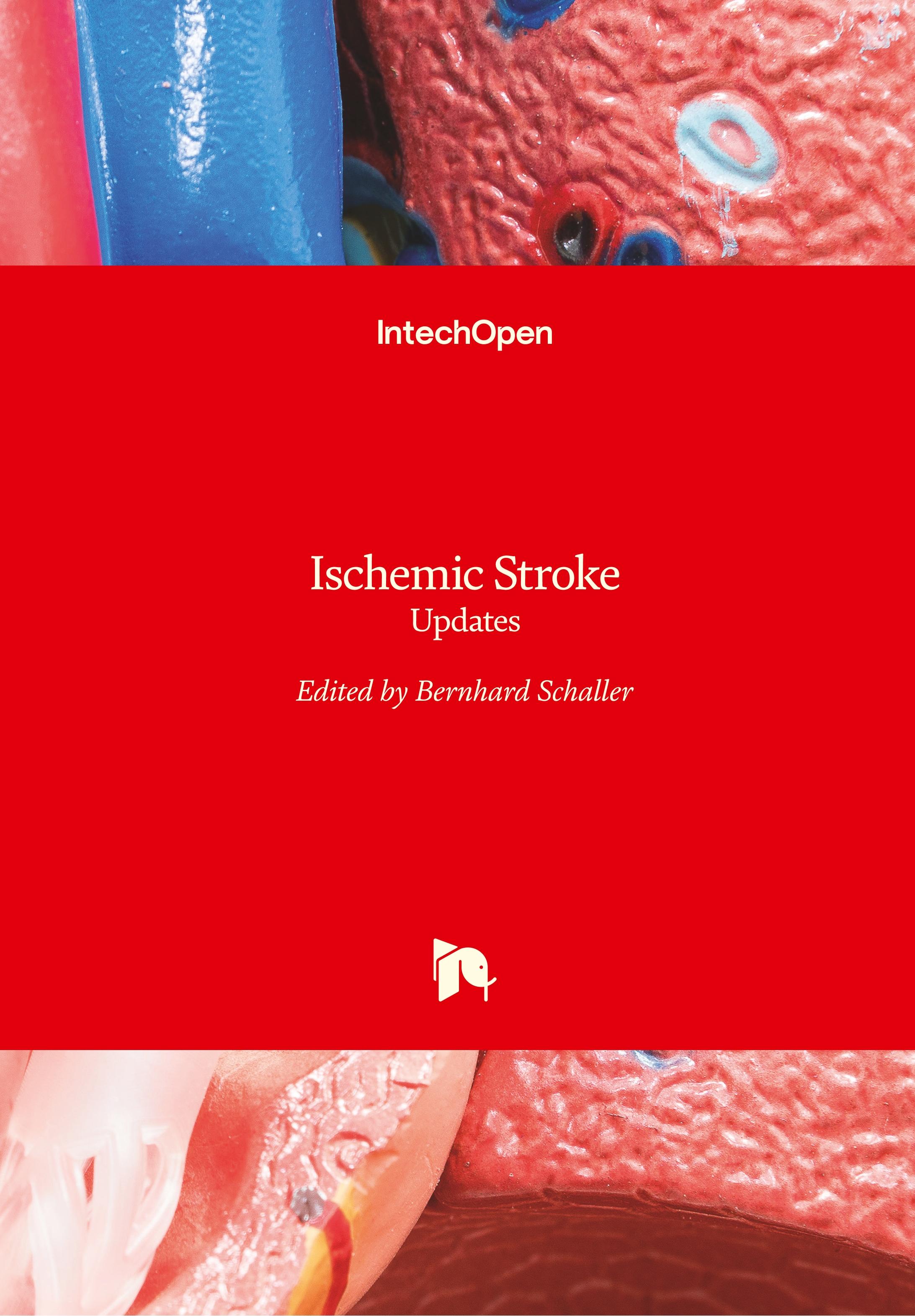 Ischemic Stroke