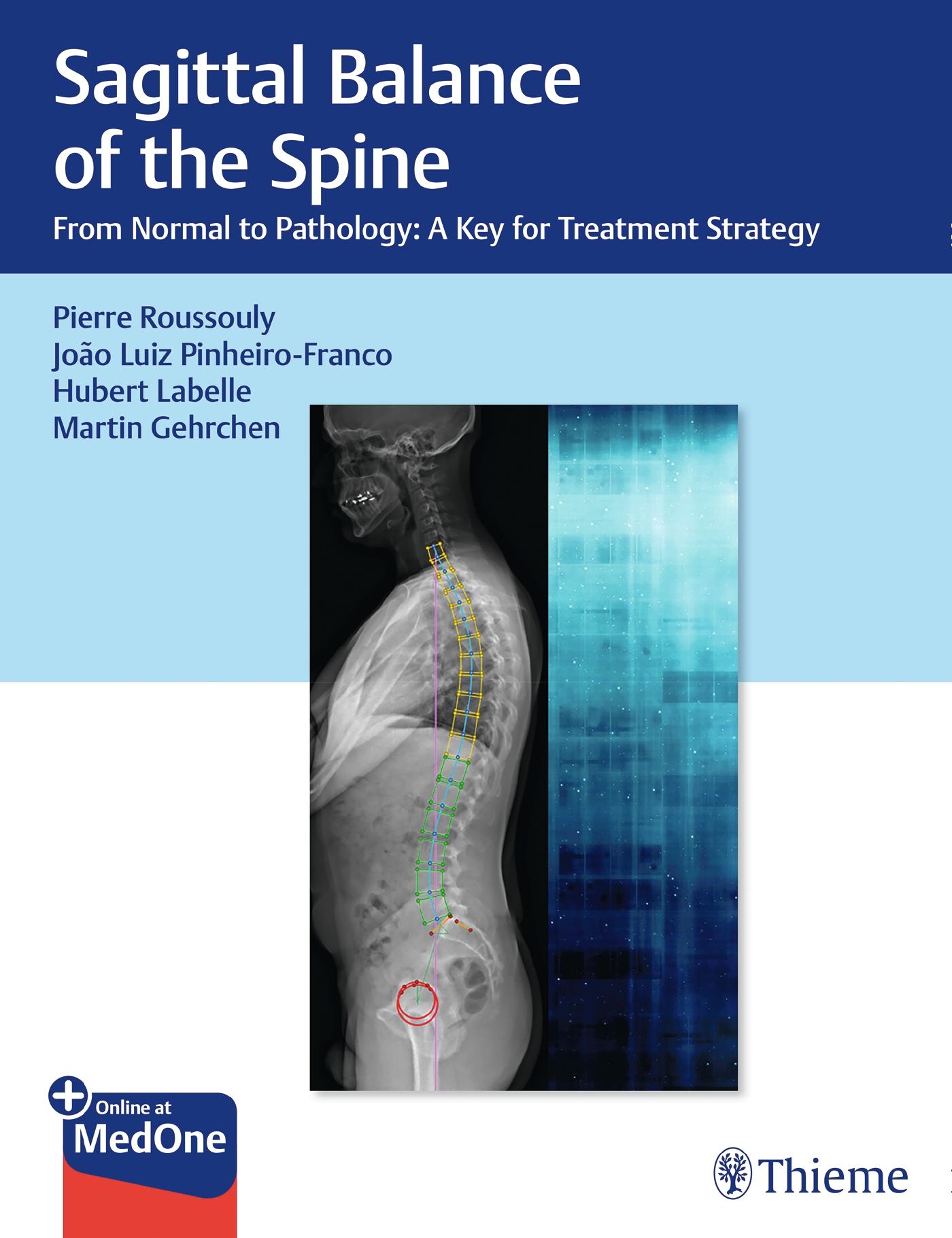 Sagittal Balance of the Spine