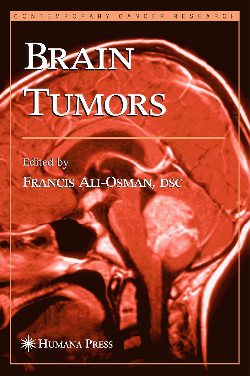 Brain Tumors