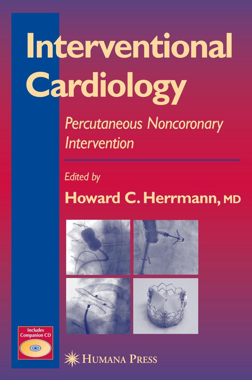 Interventional Cardiology