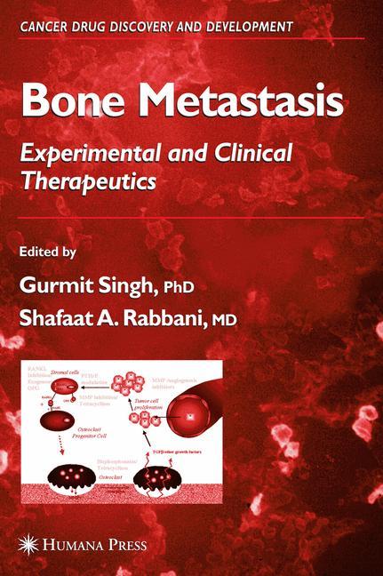 Bone Metastasis