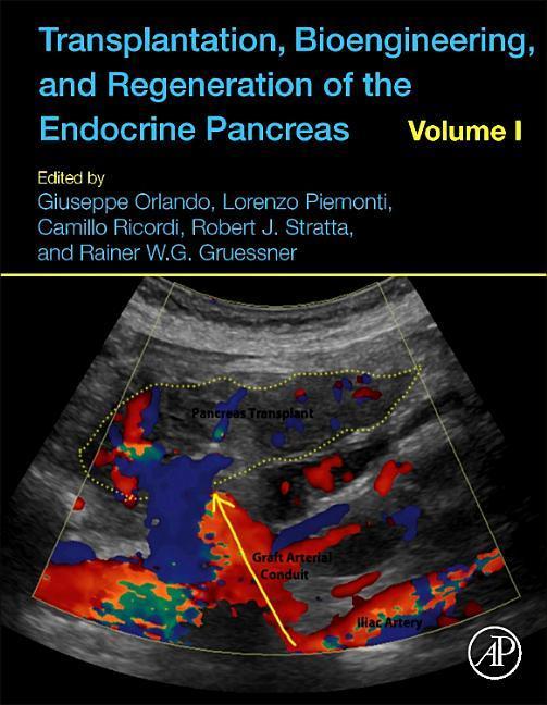 Transplantation, Bioengineering, and Regeneration of the Endocrine Pancreas