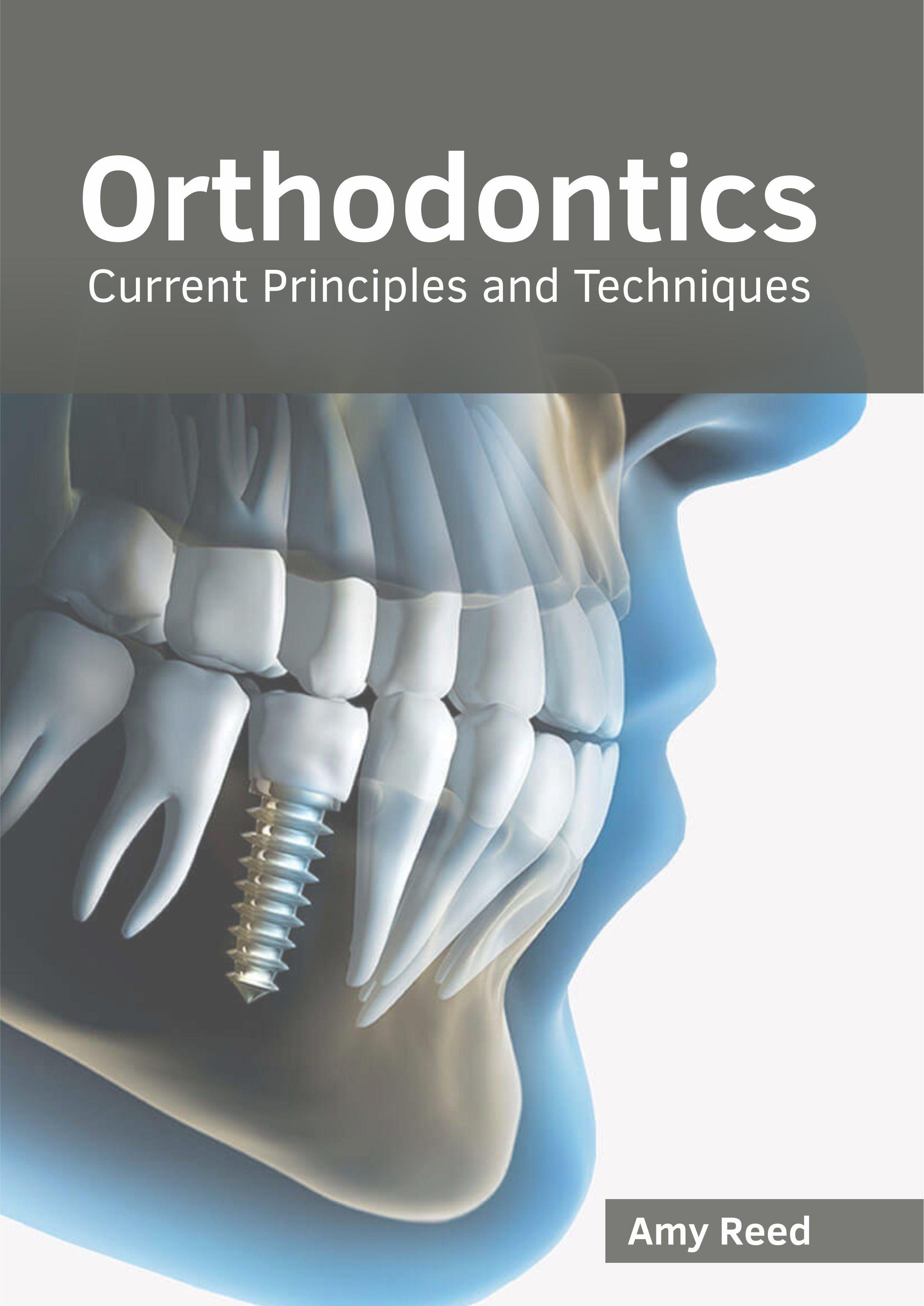 Orthodontics: Current Principles and Techniques