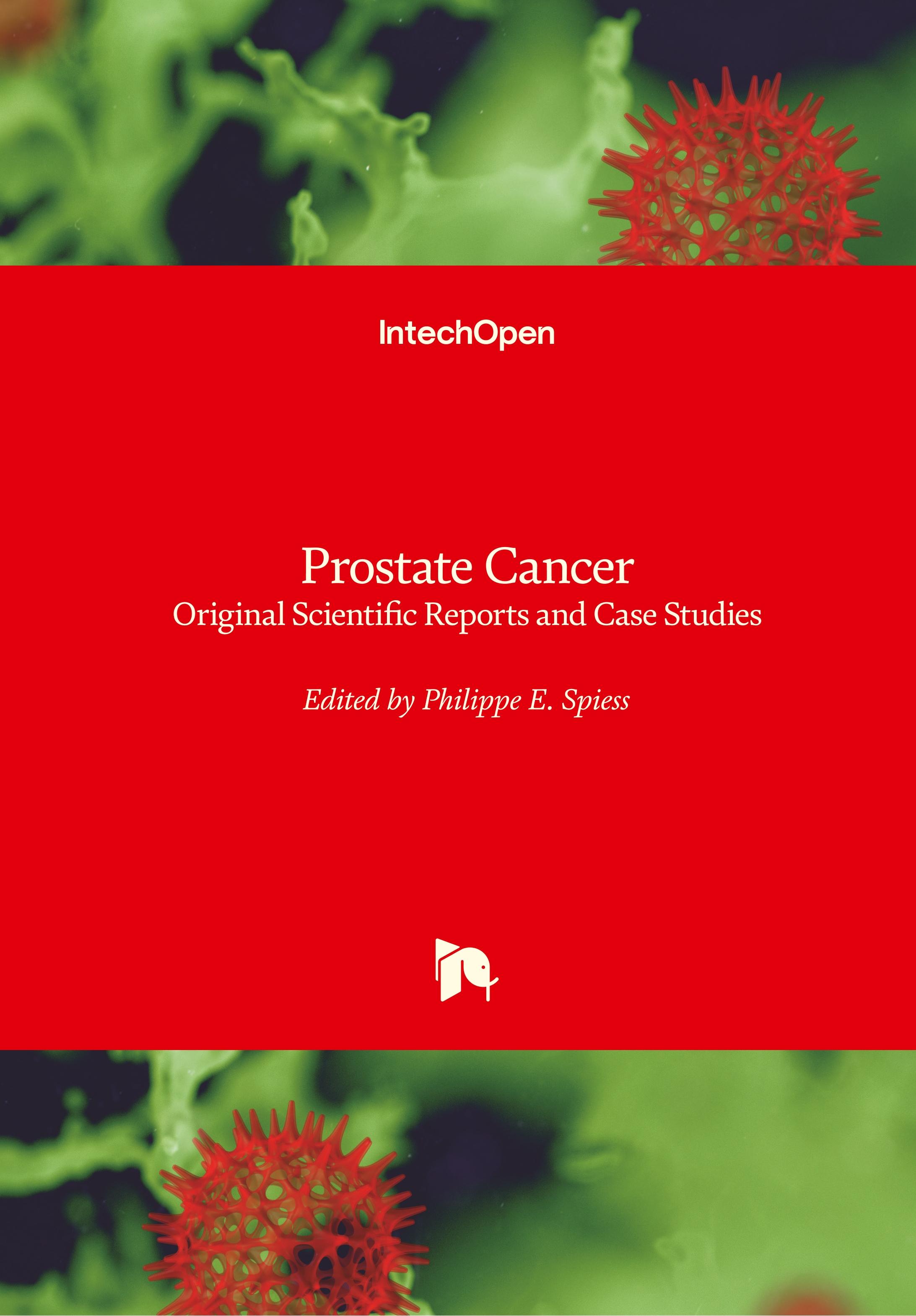 Prostate Cancer