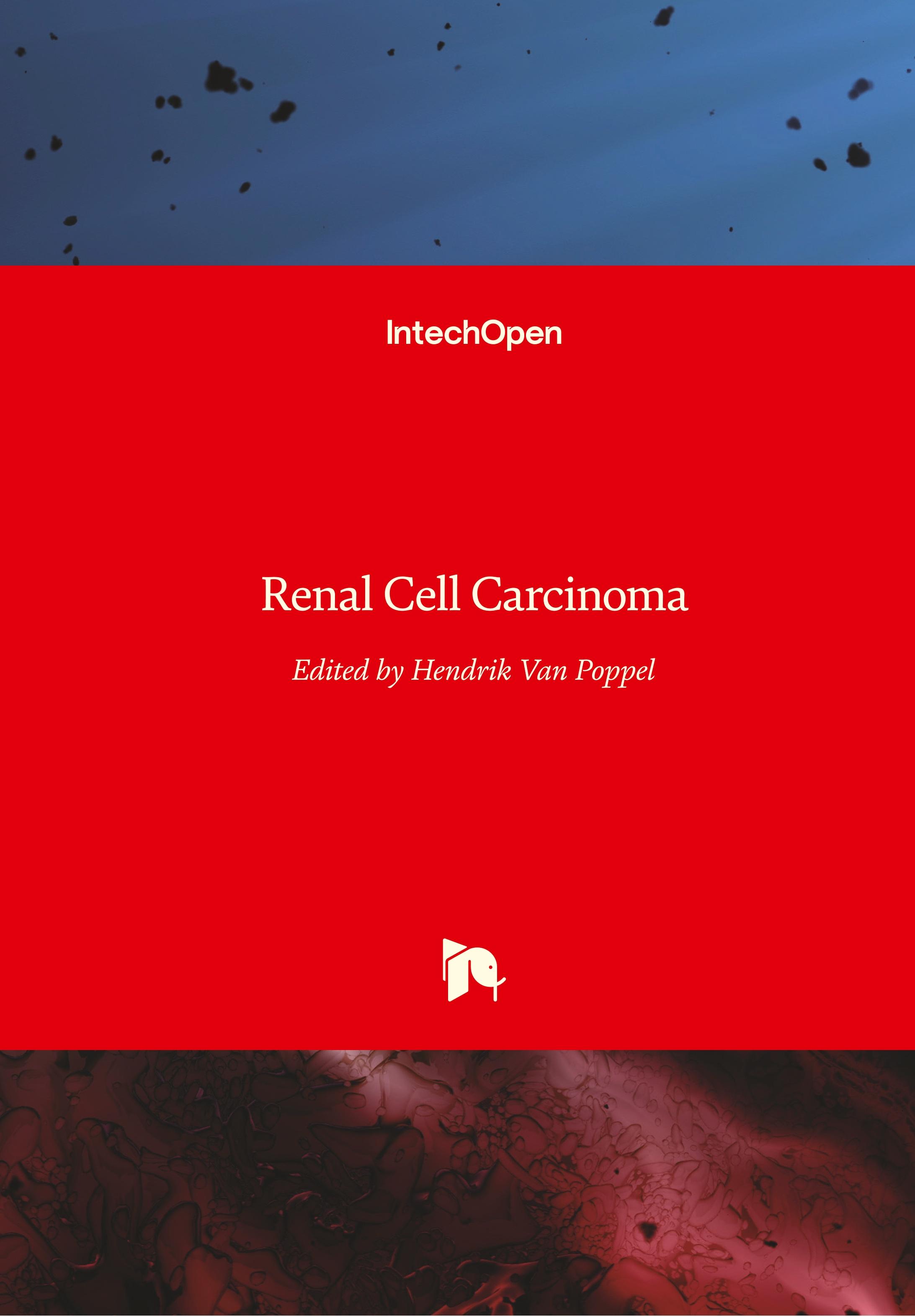 Renal Cell Carcinoma