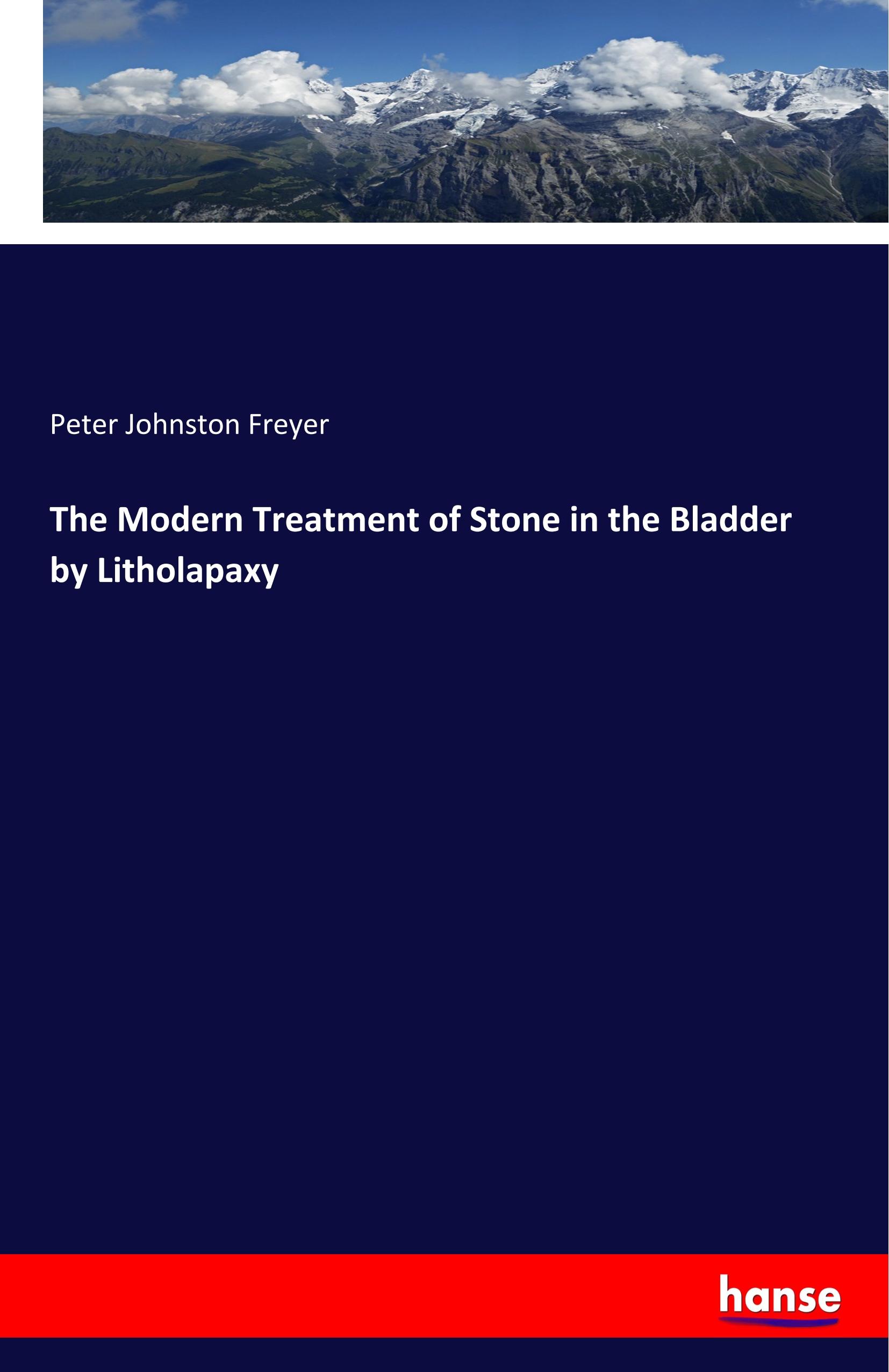 The Modern Treatment of Stone in the Bladder by Litholapaxy