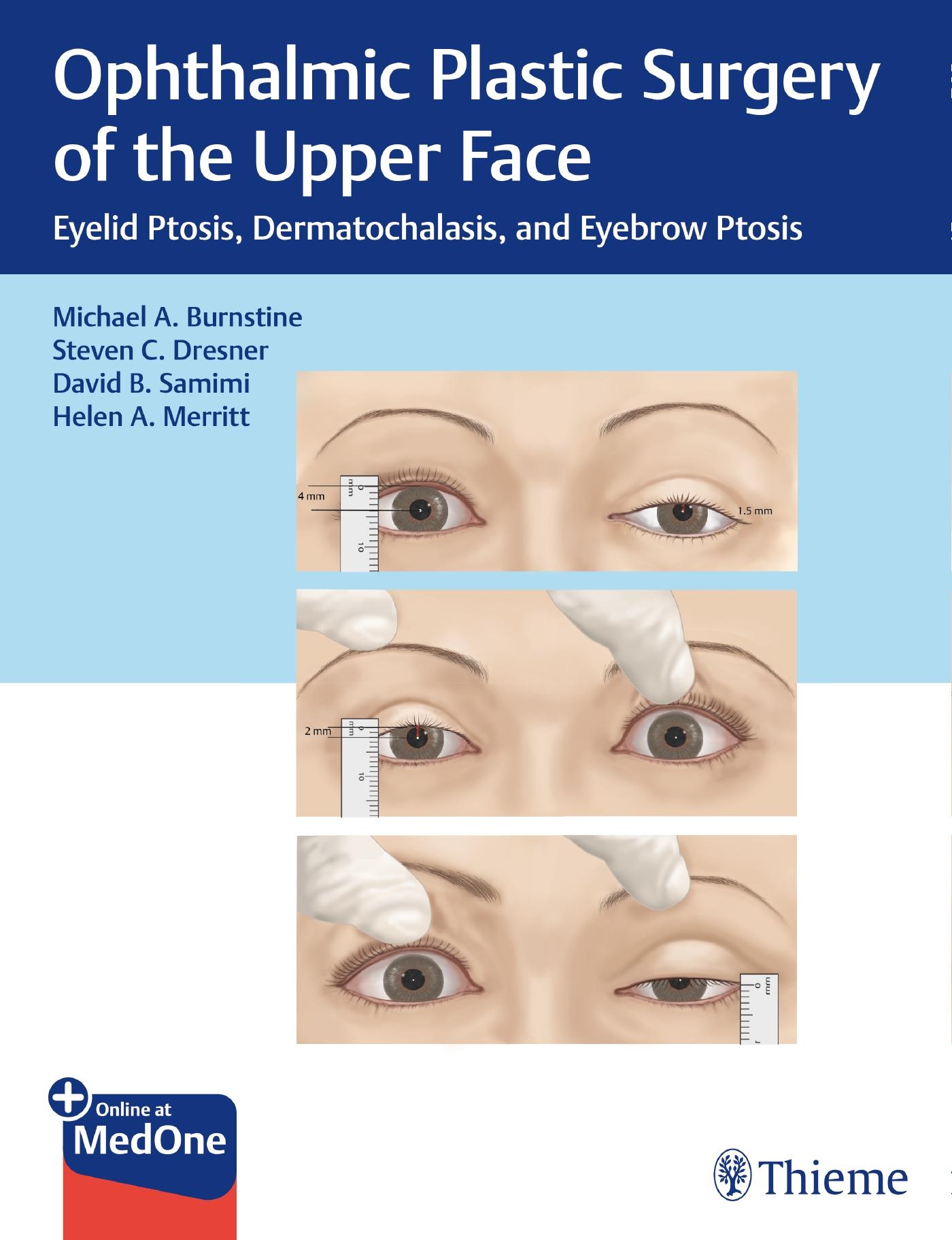 Ophthalmic Plastic Surgery of the Upper Face