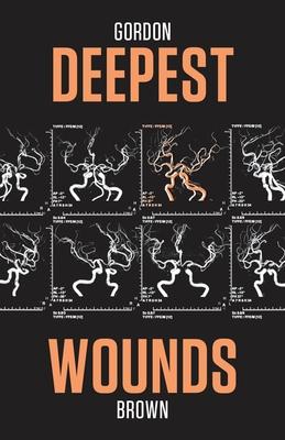 Deepest Wounds