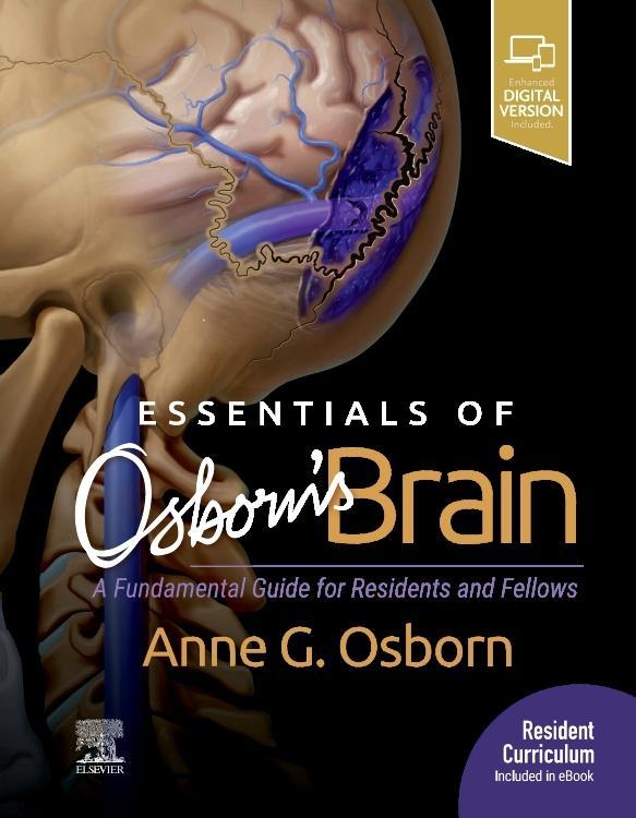 Essentials of Osborn's Brain