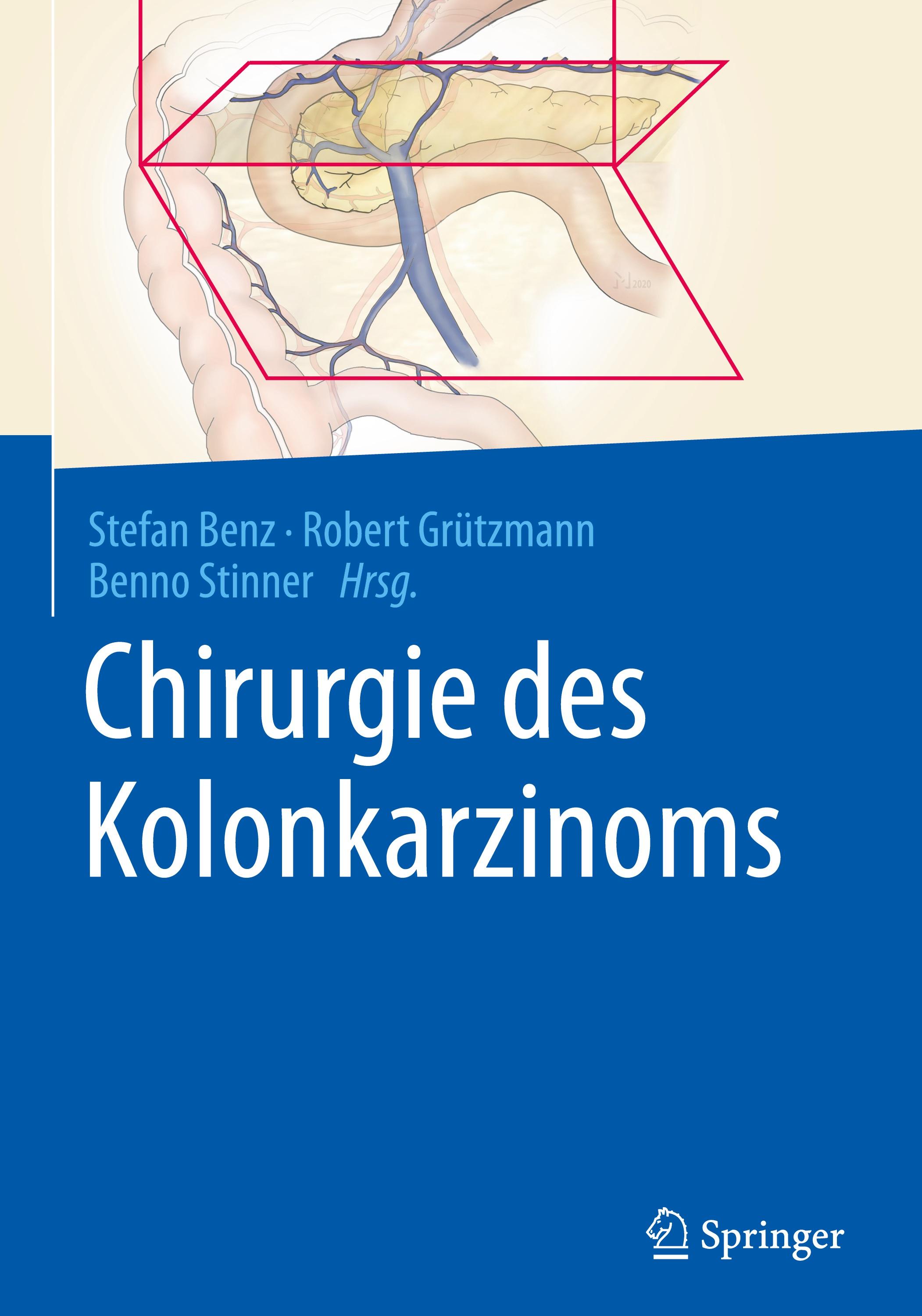 Chirurgie des Kolonkarzinoms