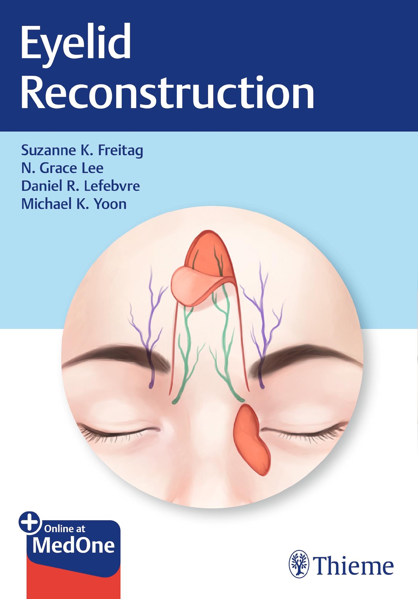 Eyelid Reconstruction