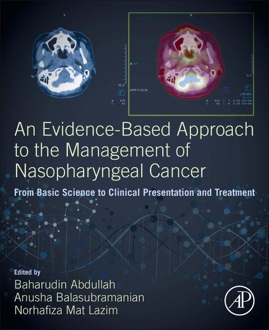 An Evidence-Based Approach to the Management of Nasopharyngeal Cancer