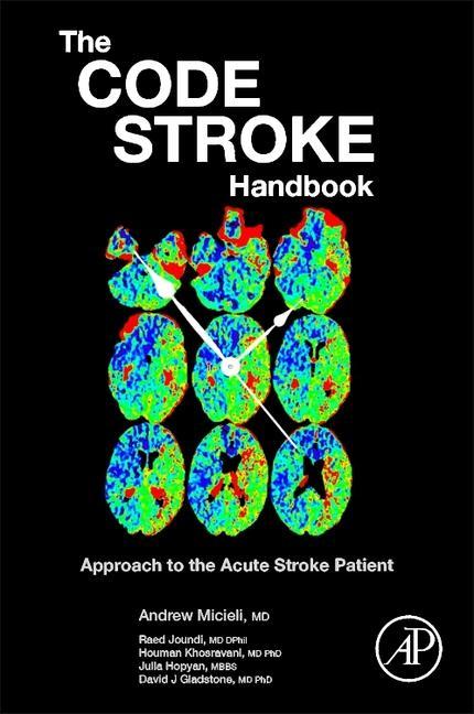 The Code Stroke Handbook