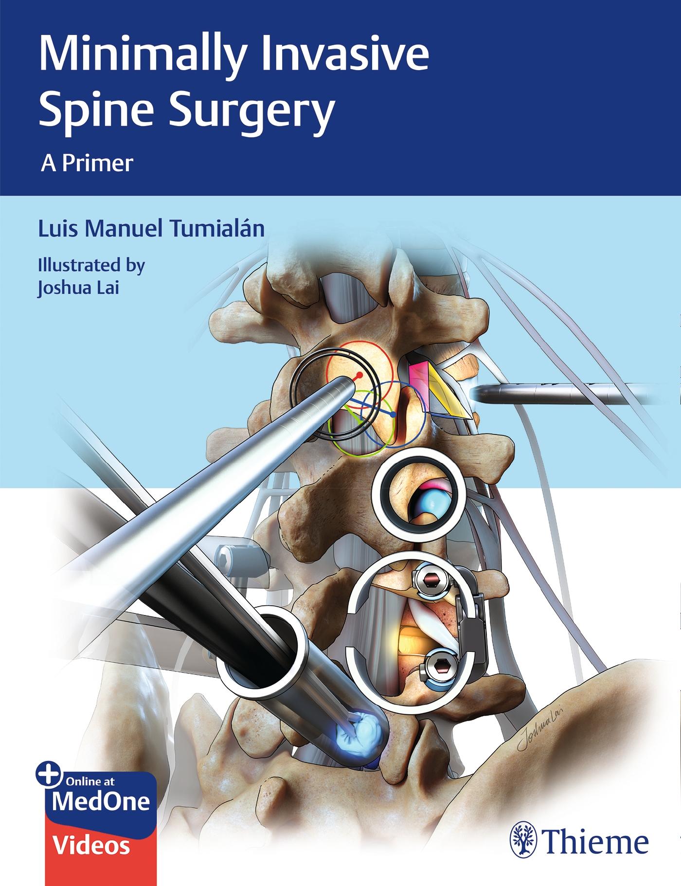 Minimally Invasive Spine Surgery