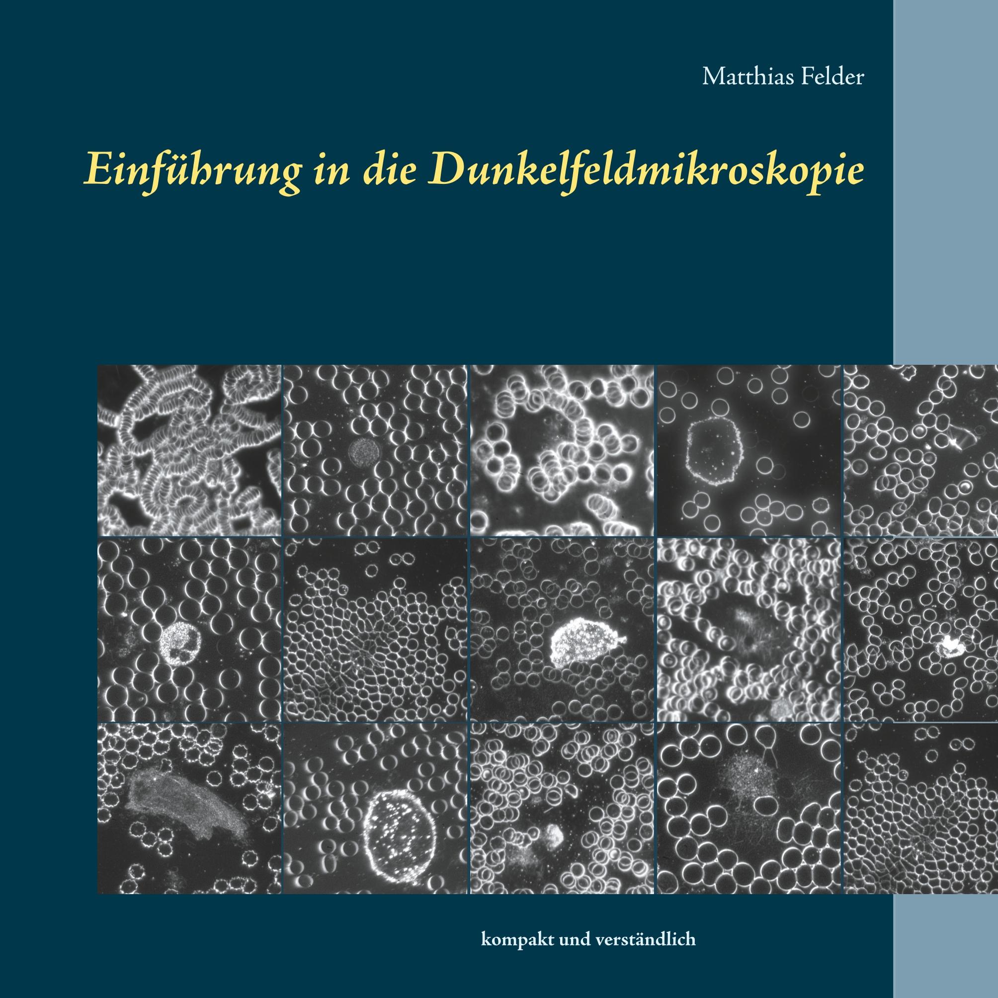 Einführung in die Dunkelfeldmikroskopie