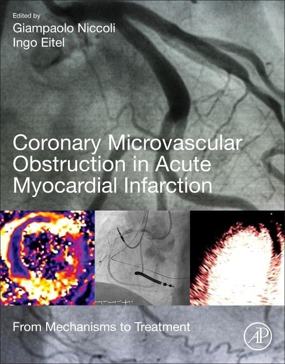 Coronary Microvascular Obstruction in Acute Myocardial Infarction