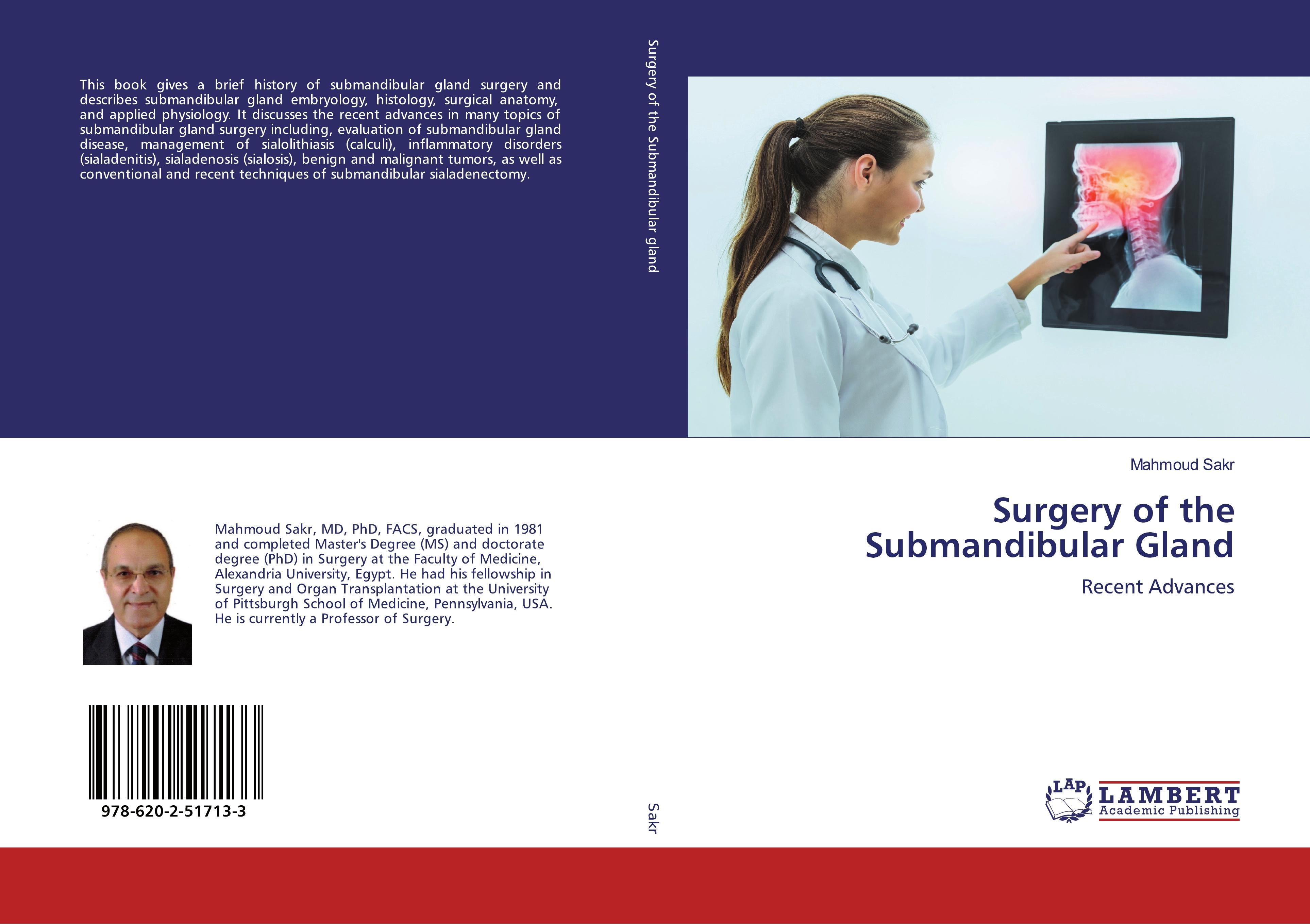 Surgery of the Submandibular Gland