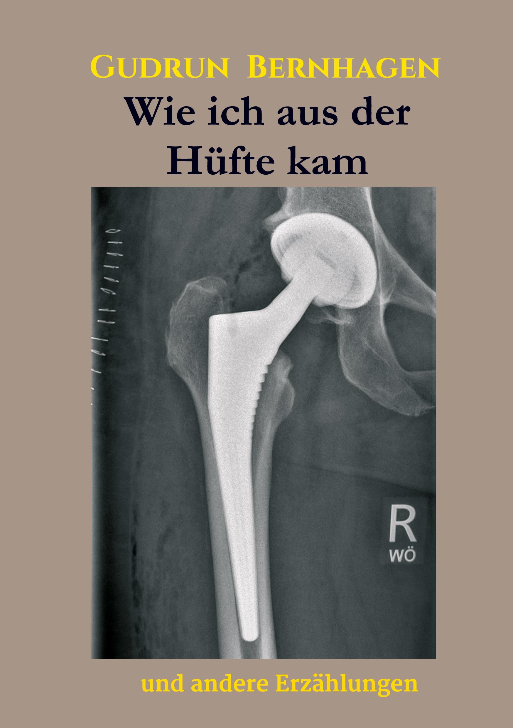 Wie ich aus der Hüfte kam