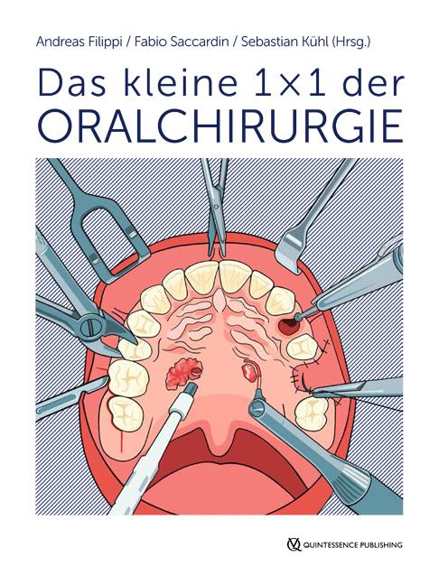 Das kleine 1 × 1 der Oralchirurgie