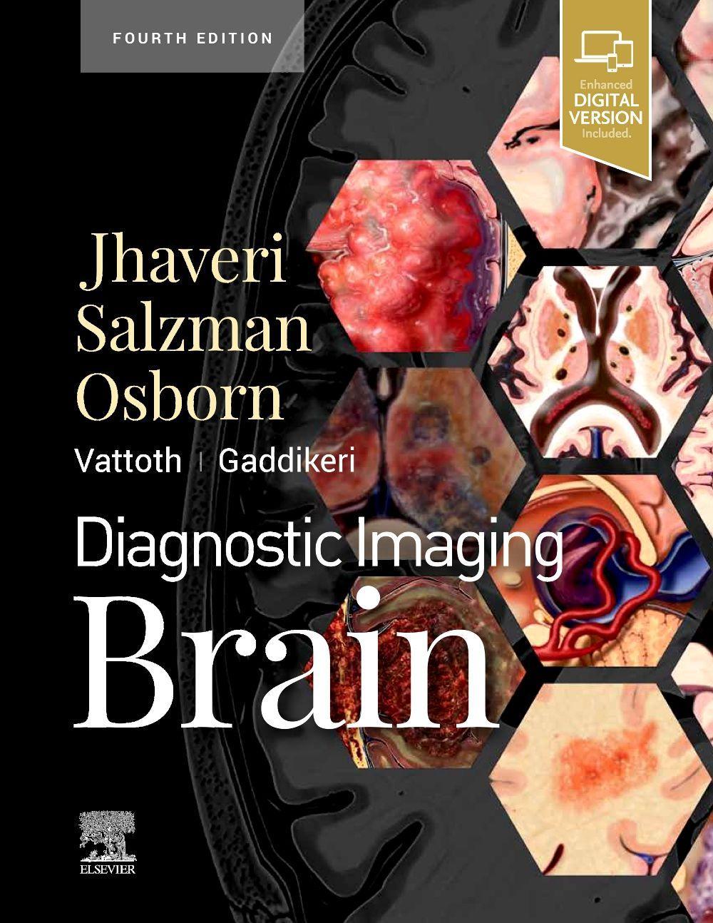 Diagnostic Imaging: Brain