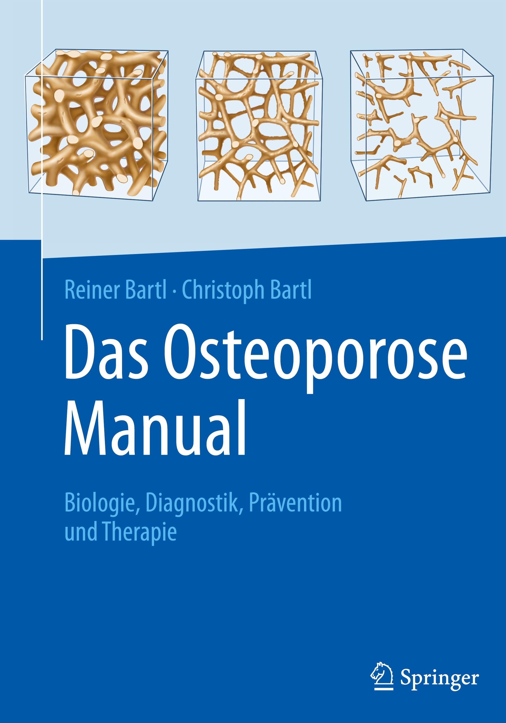 Das Osteoporose Manual