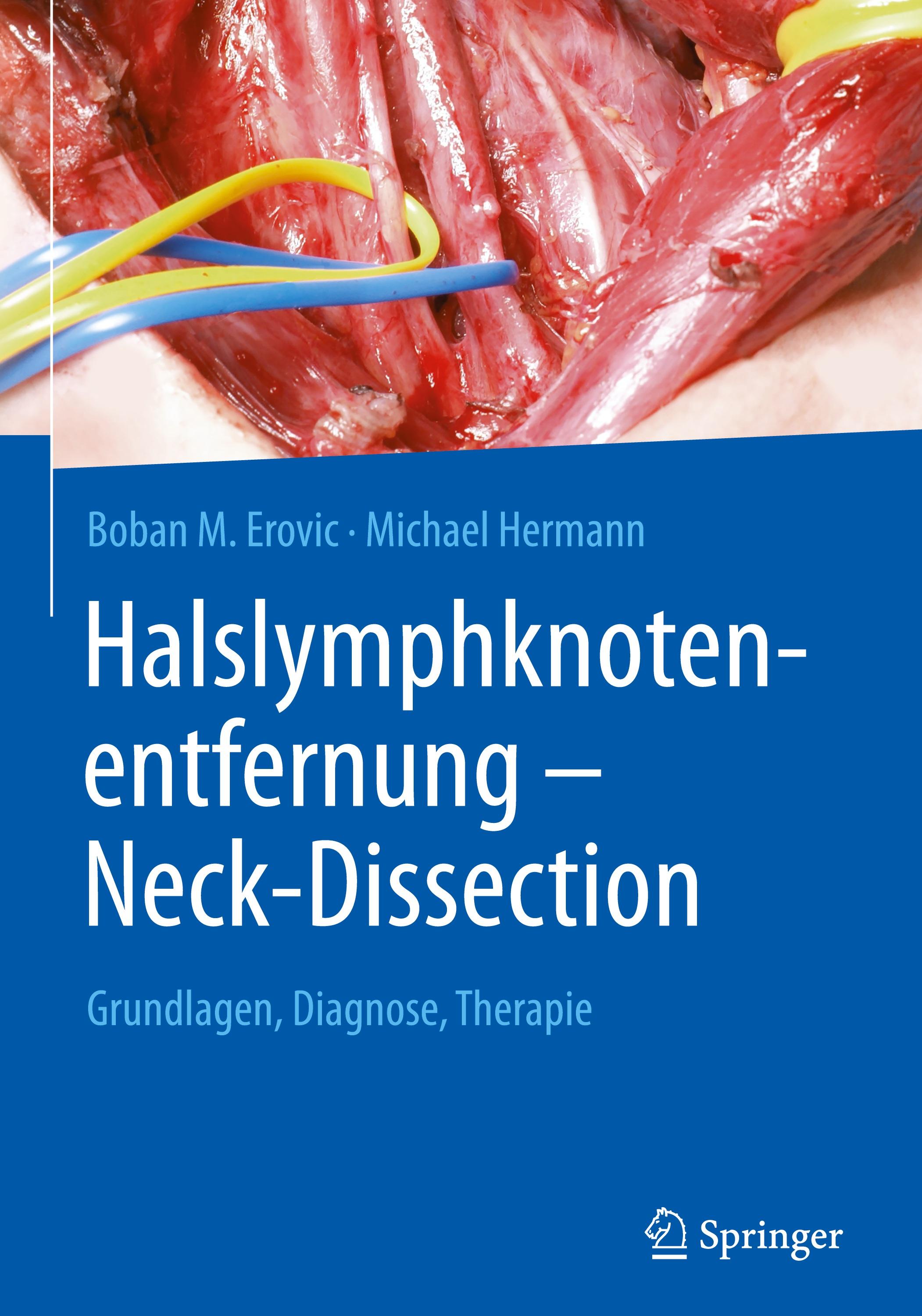 Halslymphknotenentfernung ¿ Neck-Dissection