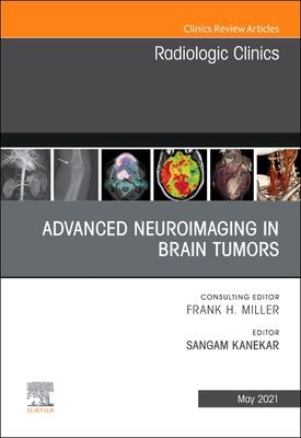 Advanced Neuroimaging in Brain Tumors, An Issue of Radiologic Clinics of North America